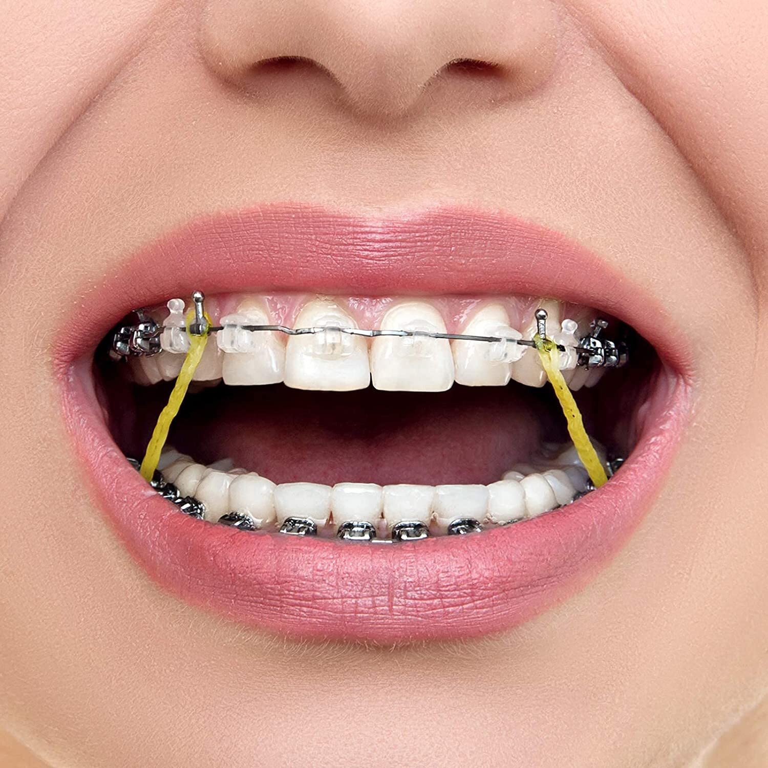 100PCS JMU Dental Orthodontics Intraoral Elastic Rubber Bands Latex Made In USA