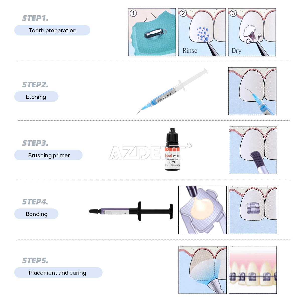 Dental Orthodontic Bonding Bracket Braces Light Cure Adhesive Primer Syringes US