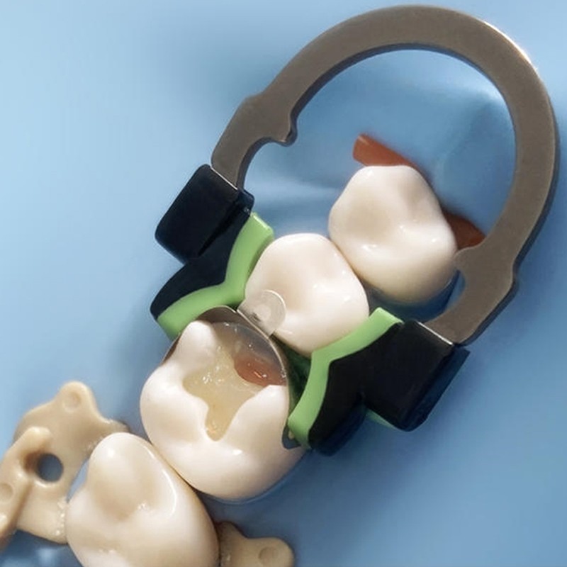 Dental Matrix Bands Ring Sectional Matrice Clamp Fit Garrison Palodent V3 System