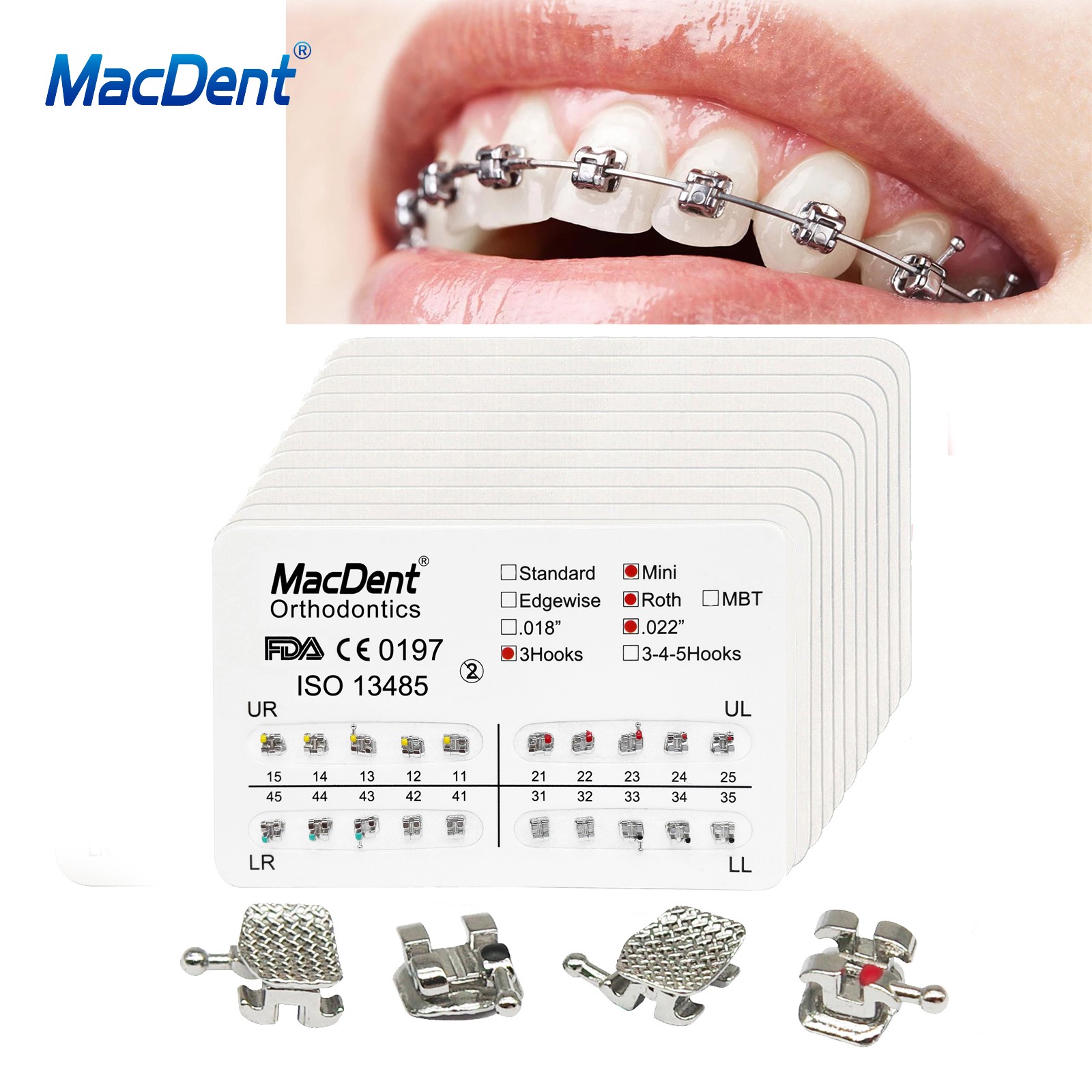 Dental Brackets /Orthodontic Light Cure Adhesive Kit/Blue Green Glue/Mini No-Mix