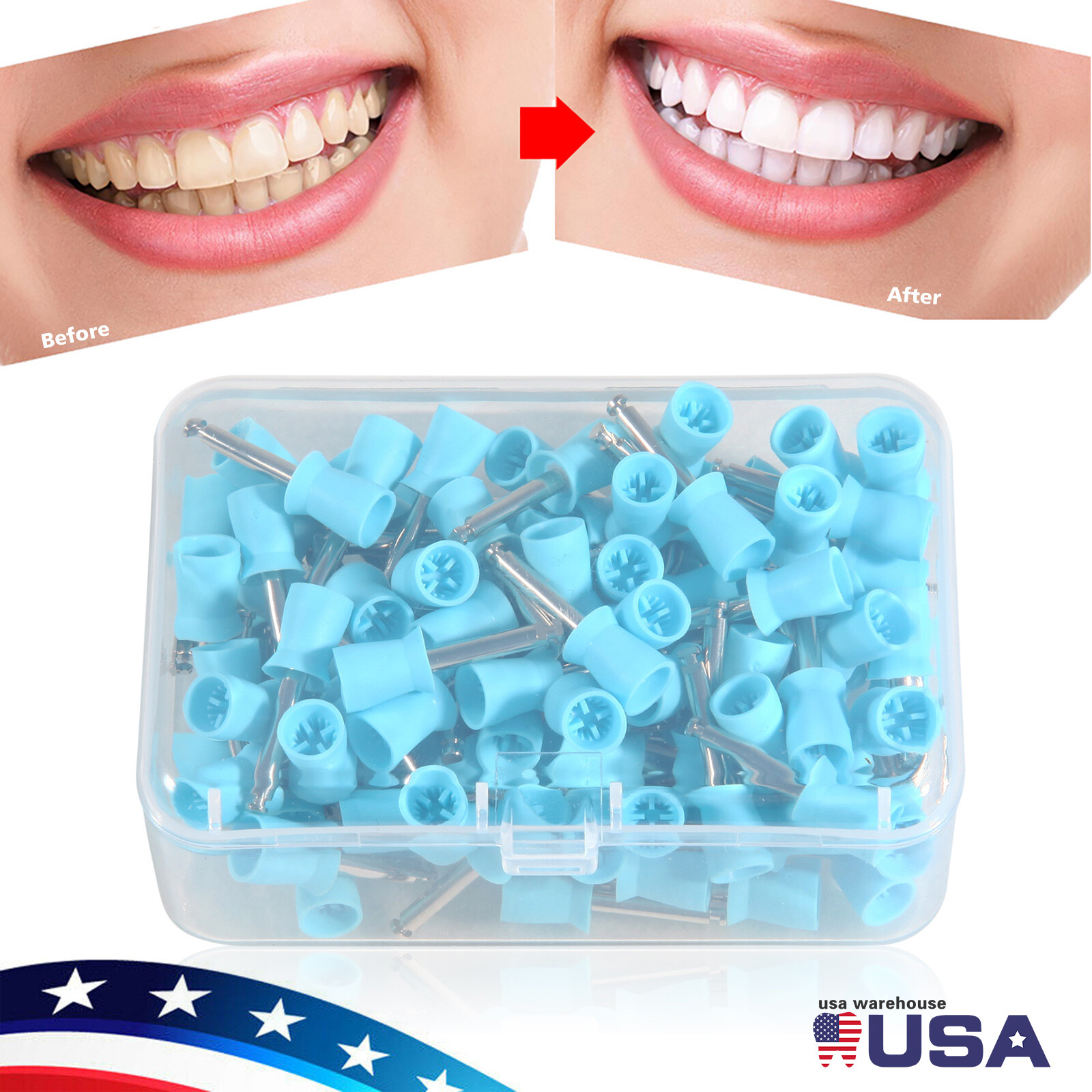 100 pieces Dental Prophy Cup Rubber Polish Polishing Tooth Latch Type Blue sx