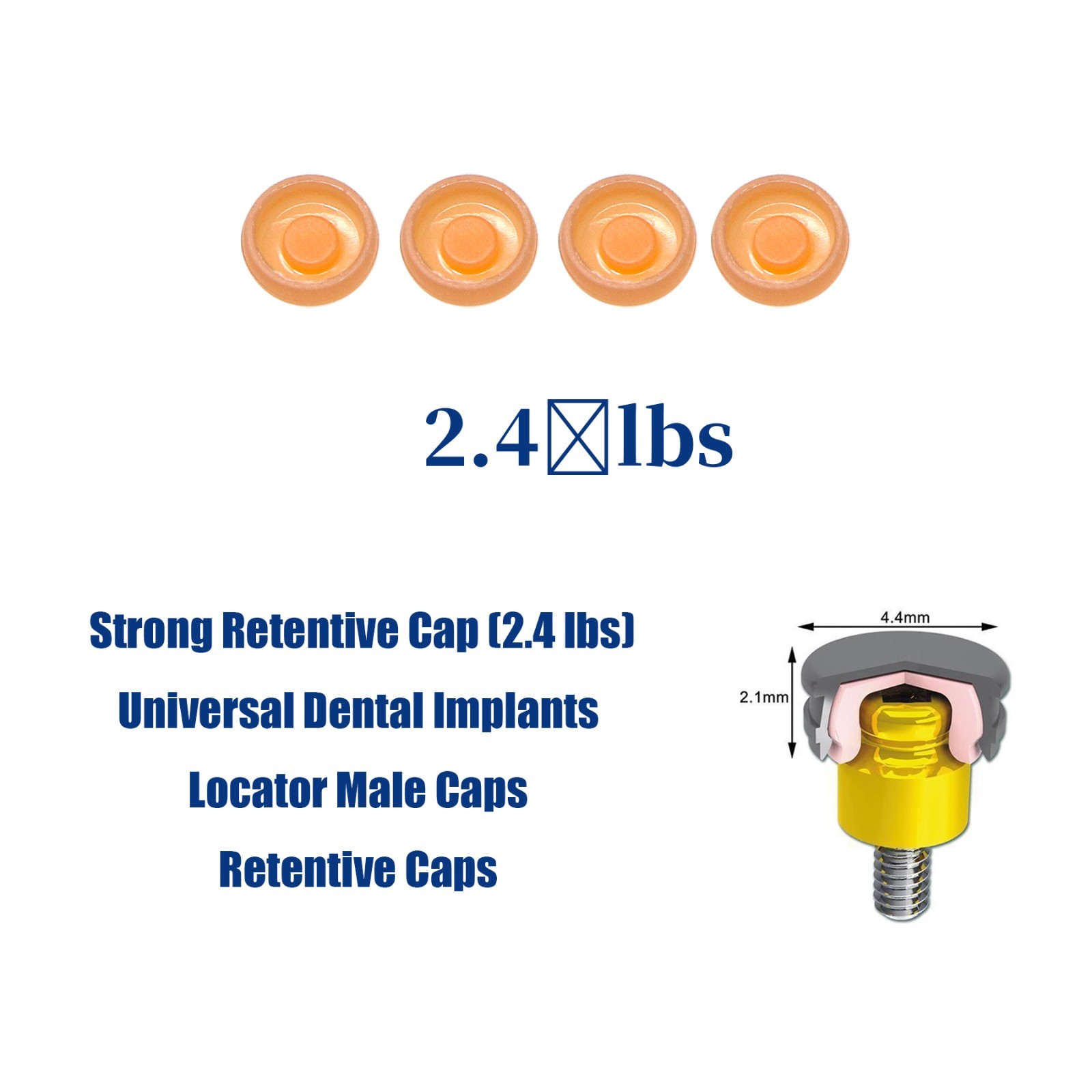 Locator Abutment for Hiossen ET DIO UF/Snucone Regular Overdenture Retention Cap