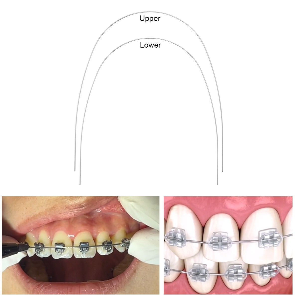 AZDENT Dental Orthodontic Super Elastic NITI Rectangular Arch Wires Ovoid Form