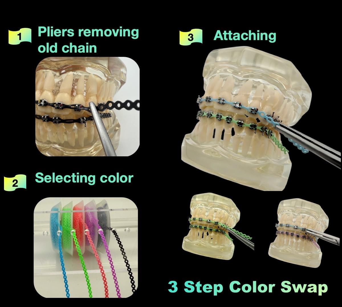Braces Power Chains Short 5 Colors (Blue, Green, Pink, Purple, Multicolor