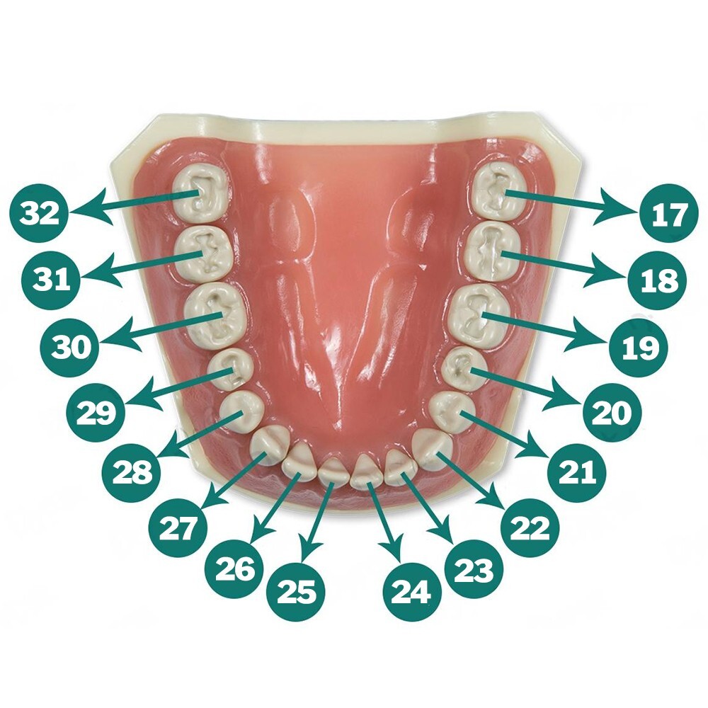 Ivorine Teeth Typodont 860 – Cavity Prep 5 PACK Compatible w/ Columbia 860 Brand