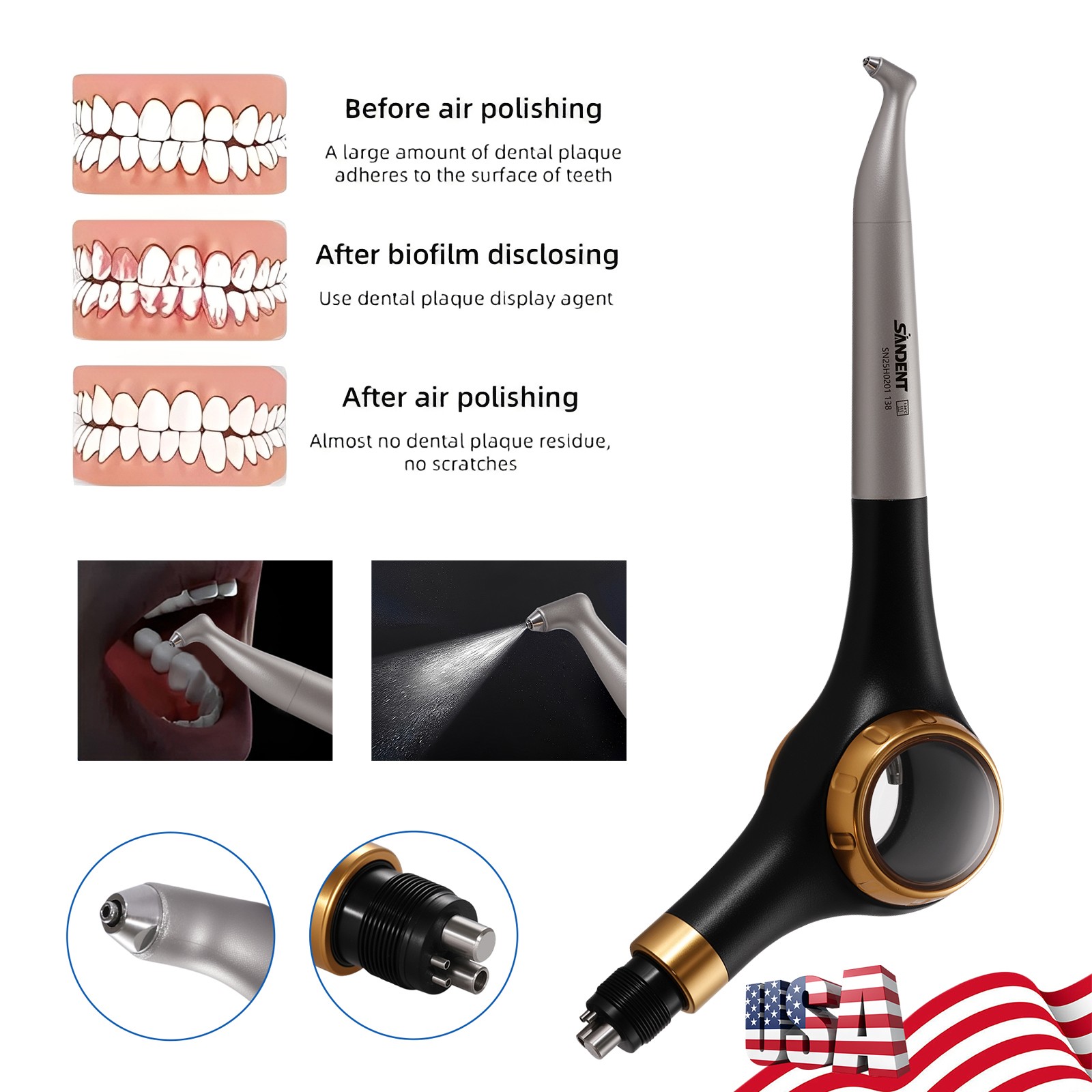 Woodpecker Style Dental Air Polisher AP-H Supragingival Polishing Handpiece