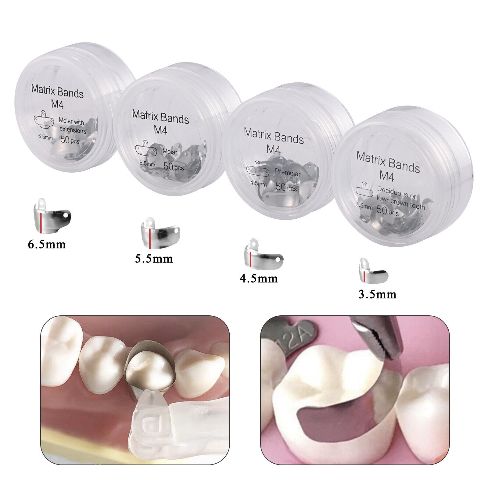 50Pc Dental Sectional Contoured System Matrix Bands M4 Metal Matrices Refill USA