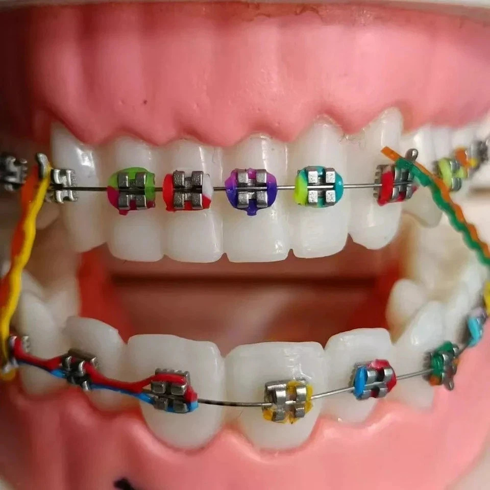 Dental Orthodontic Elastic Ligature Ties Rubber Bands Brace Single/Double Color