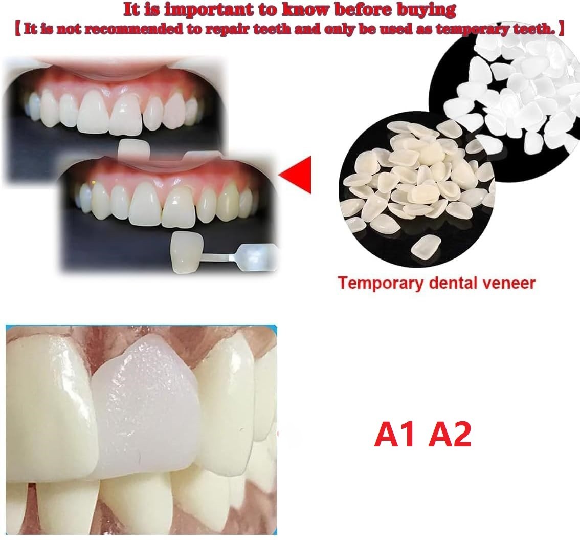 Temporary Tooth Repair Kit Tooth Cover Veneers Teeth – Piece Yellow / White US