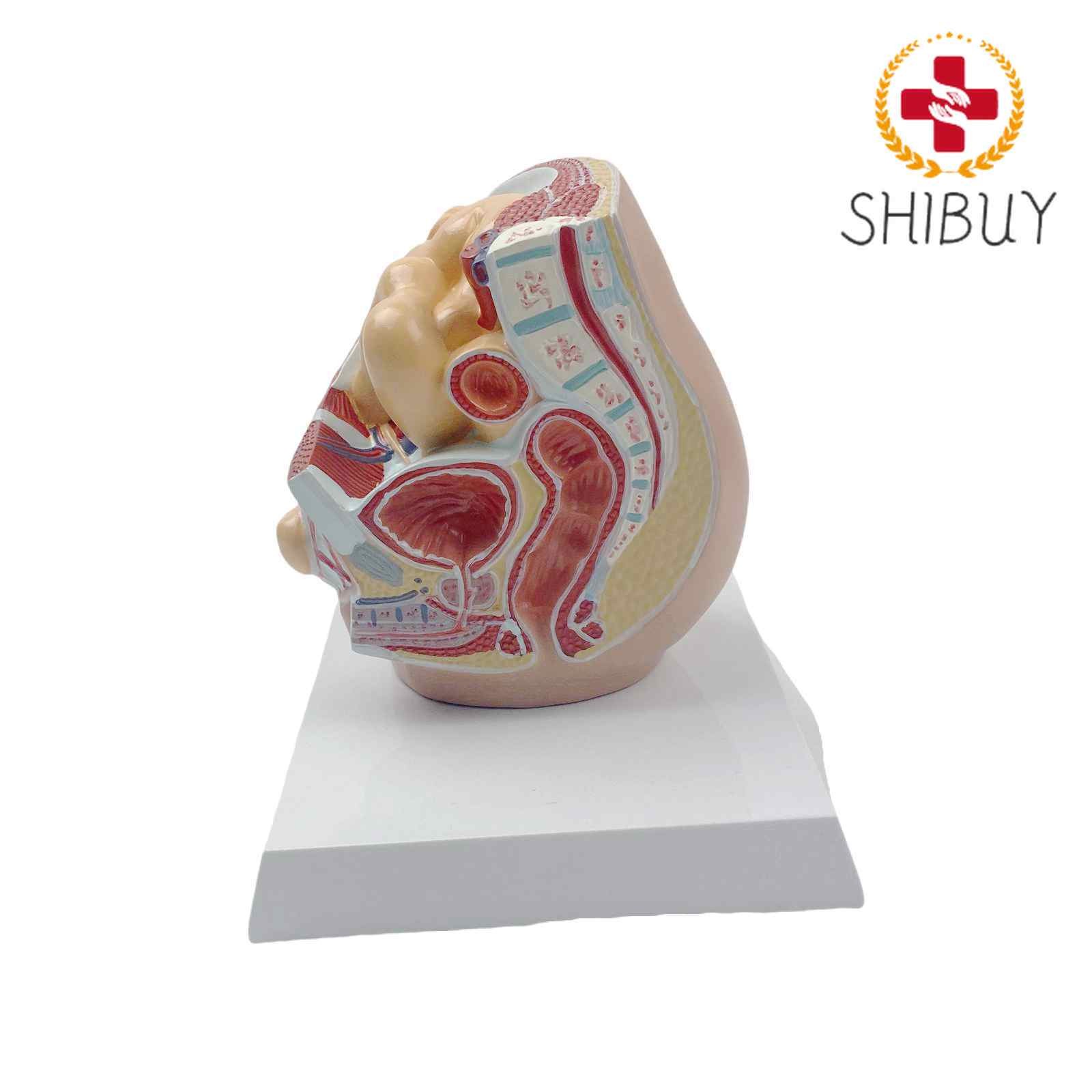 Human Oblique Inguinal Hernia Pathological Skin Model Medical Teaching Models