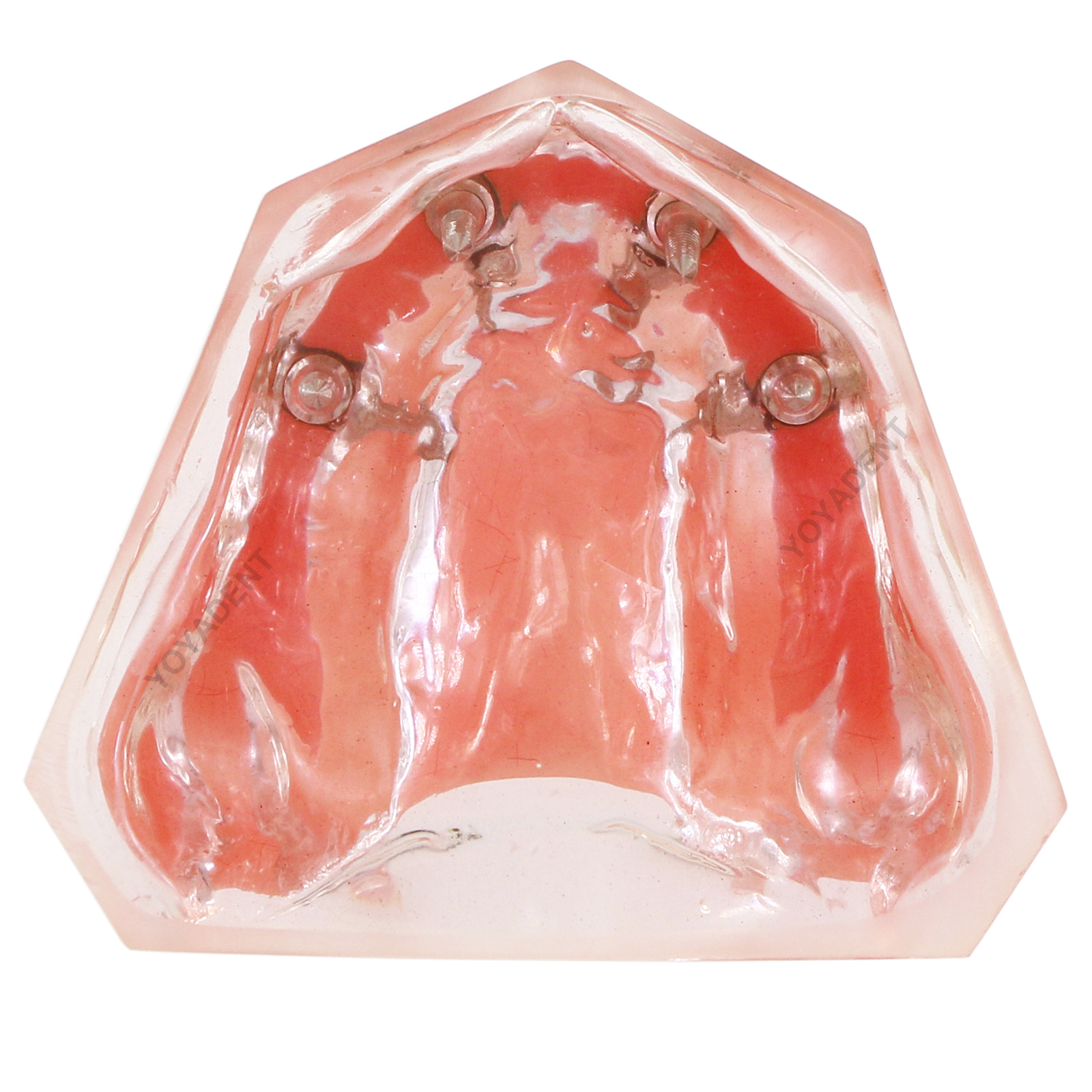 US Dental Teeth Model Ortho Implant Practice Teaching With Implants Demo Model