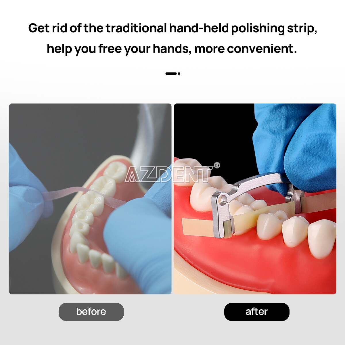 Dental Polishing Strip Coarse Medium Fine 50/30/20μm Polishing Resin Restoration
