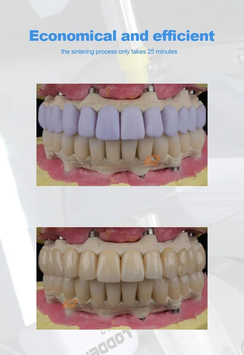 C14 Dental Lithium Disilicate Glass Ceramic Block LT CAD/CAM CEREC Emax 5Pcs/Box