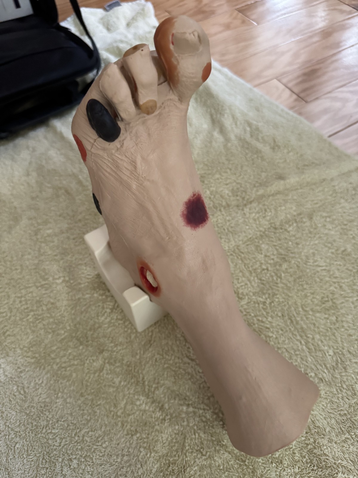 VATA Wilma Wound Foot Teaching Model