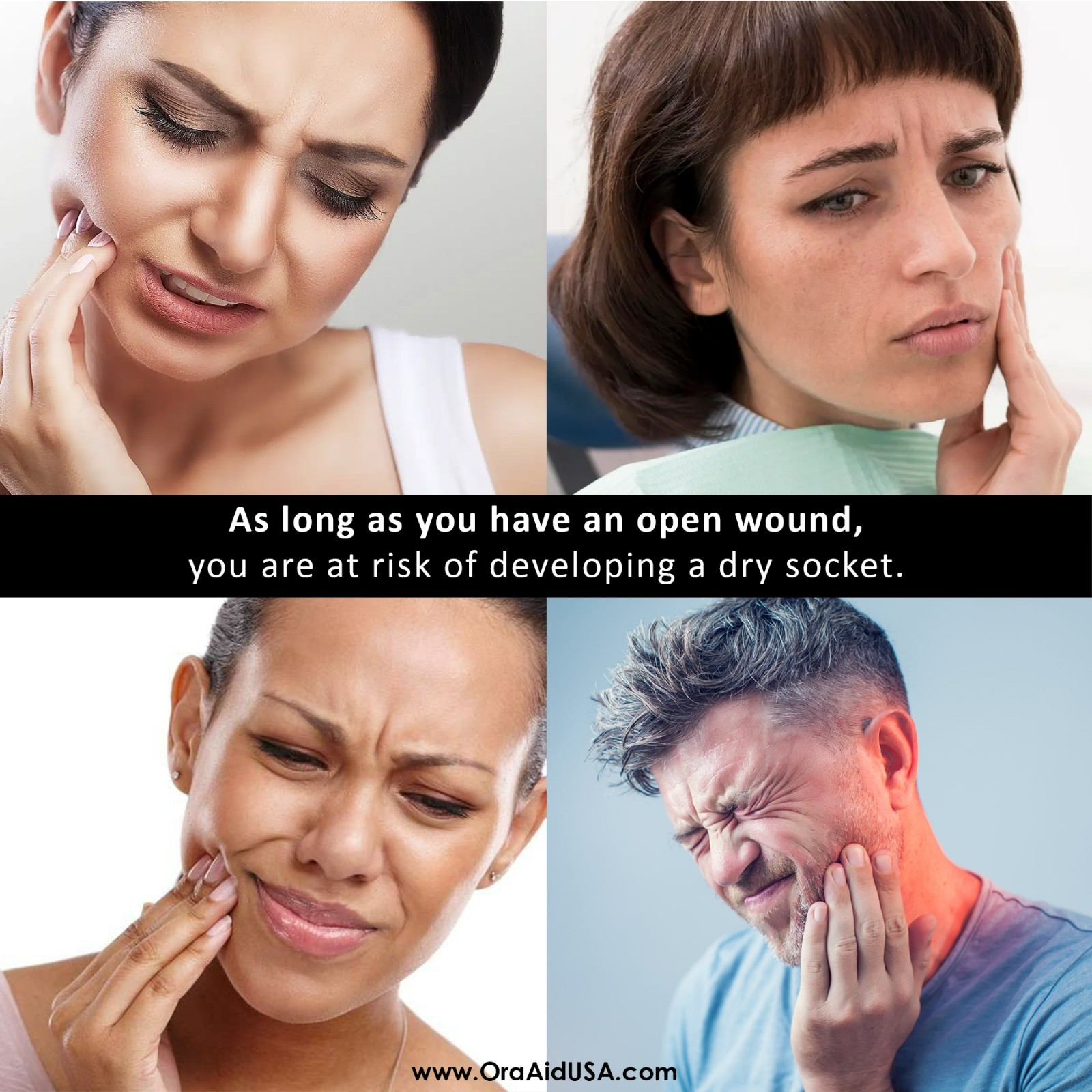 Ora-Aid 4 single-use packs | Self-Adhesive Intraoral Wound Dressing
