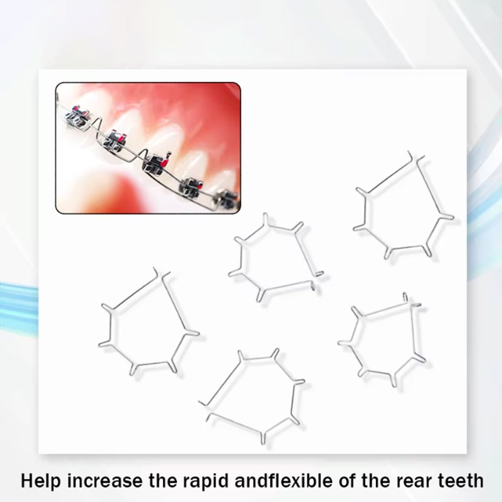 Dental Orthodontic Anterior Root Torquing Auxiliary Arch 5Pcs/Pack