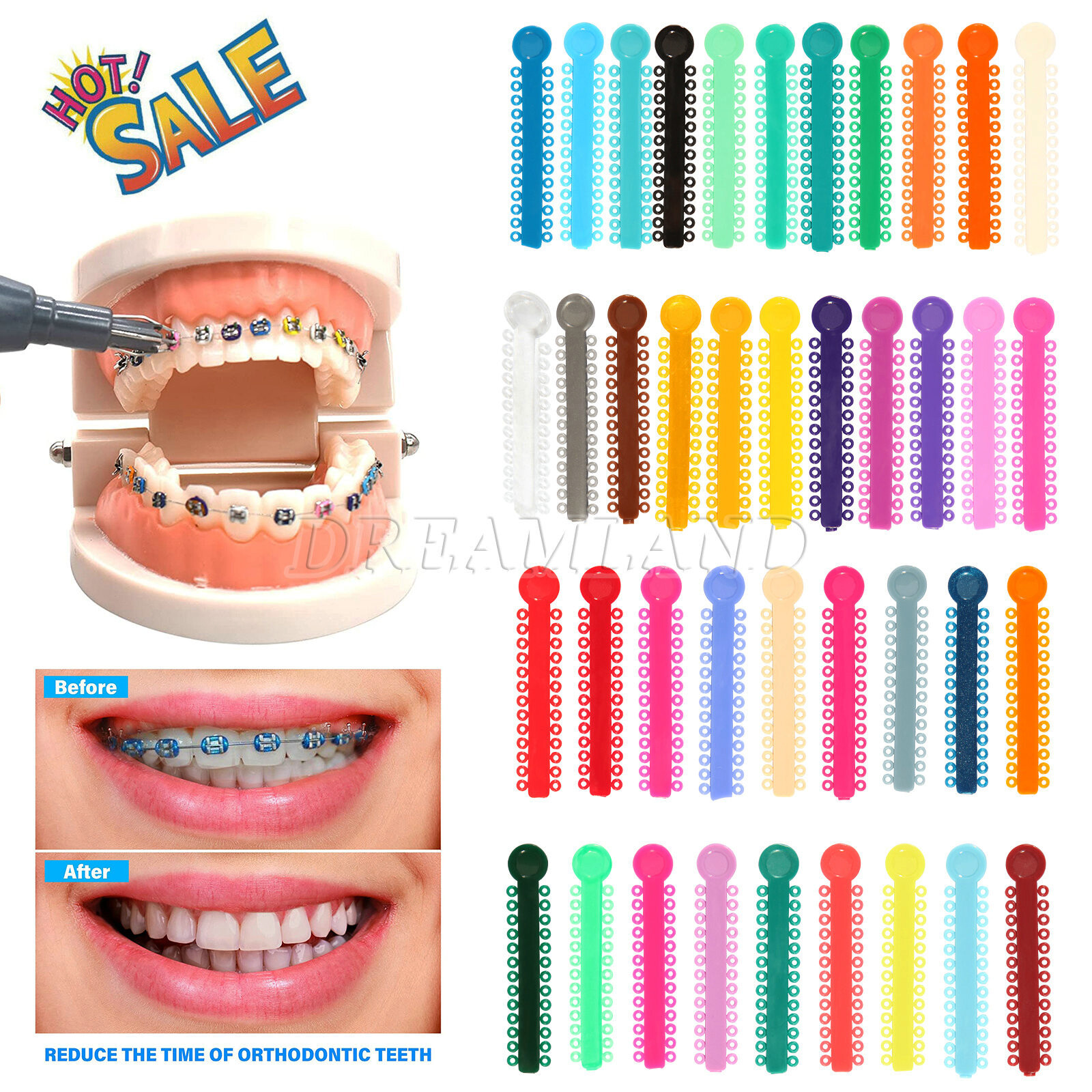 1040 Pcs Ligature Tie Dental Orthodontics Ring Elastic Latex Bands 45 Colors