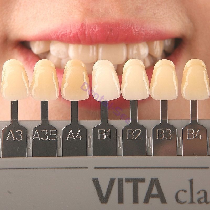 New 1 Set VITA Classical Dental Shade Guide 19Colors with Bleached Shades Clip