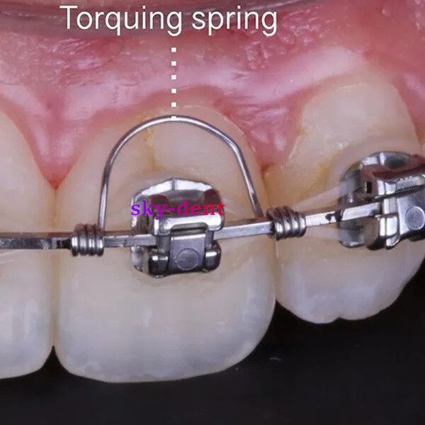 Dental Orthodontic Torquing Torque Spring Rectangular Anterior Teeth Wires L/M/S