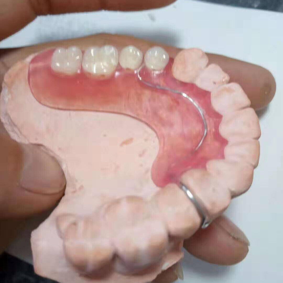 Dental Flexible Denture Acrylic with Blood Streak Color A 100g