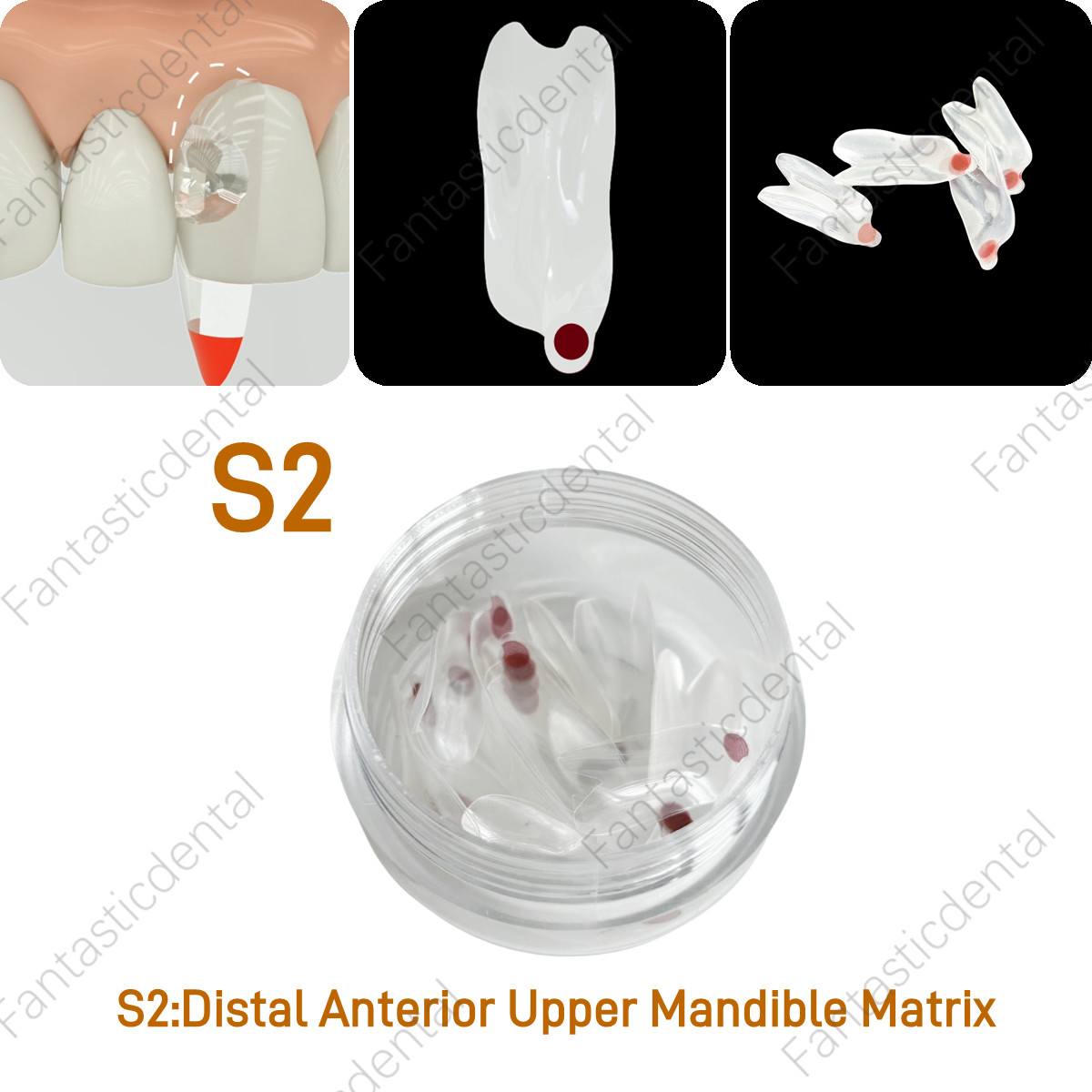 Dental Transparent Matrix Clear Bow Matrice Band Anterior Front Bioclear TorVM