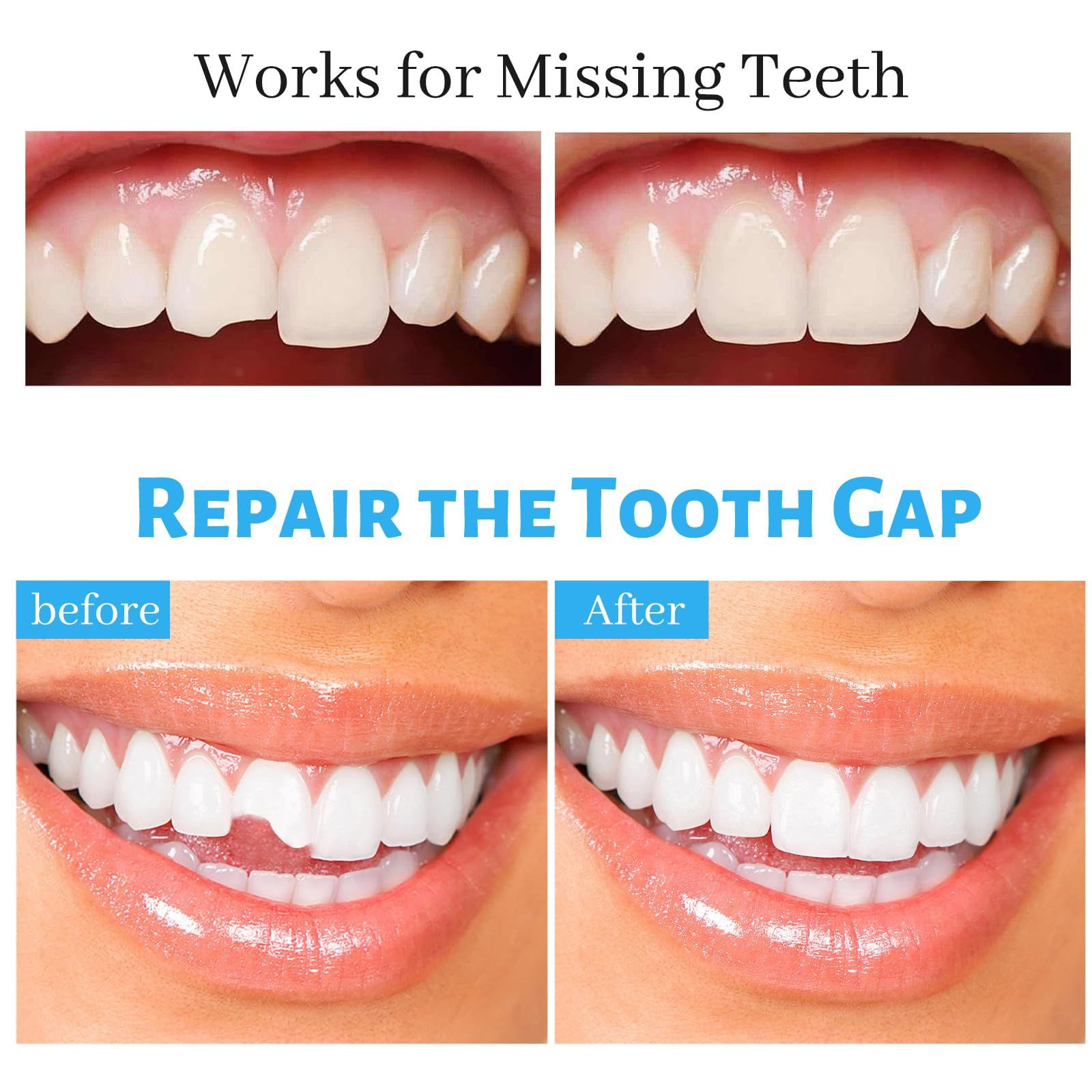 Tooth Repair Kit, Fake Teeth Replacement Kit – 0.33 Fl Oz (Pack of 3)
