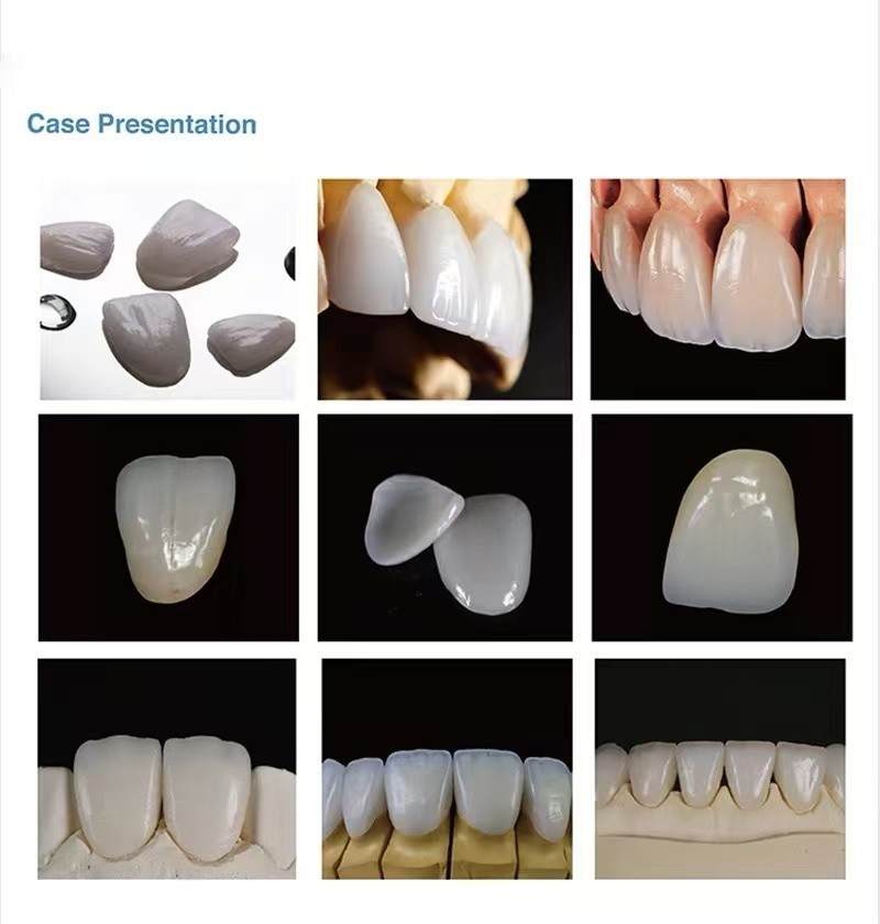US C14 LT Glass Ceramic Blocks Lithium Disilicate CAD/CAM Cerec Blocks 5Pcs/Box
