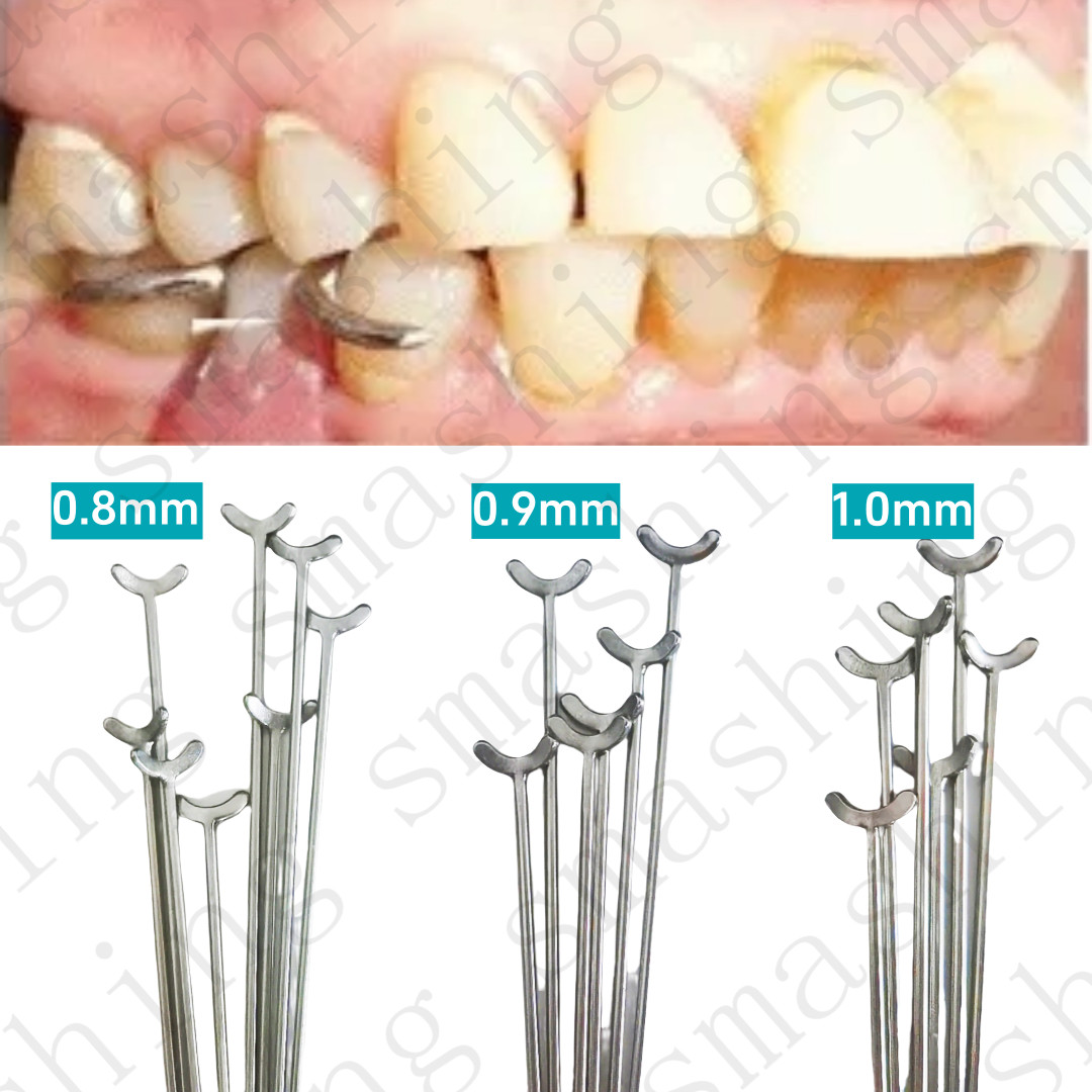 Dental Ortho Y-Type Retainer Clasp Wire Oblique Bar Teeth Position Hold