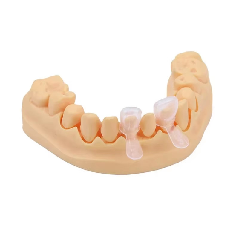 5 Pcs/Box Dental Resin Primary Kids Strip Crown Form-Pedo Kids Anterior Crowns