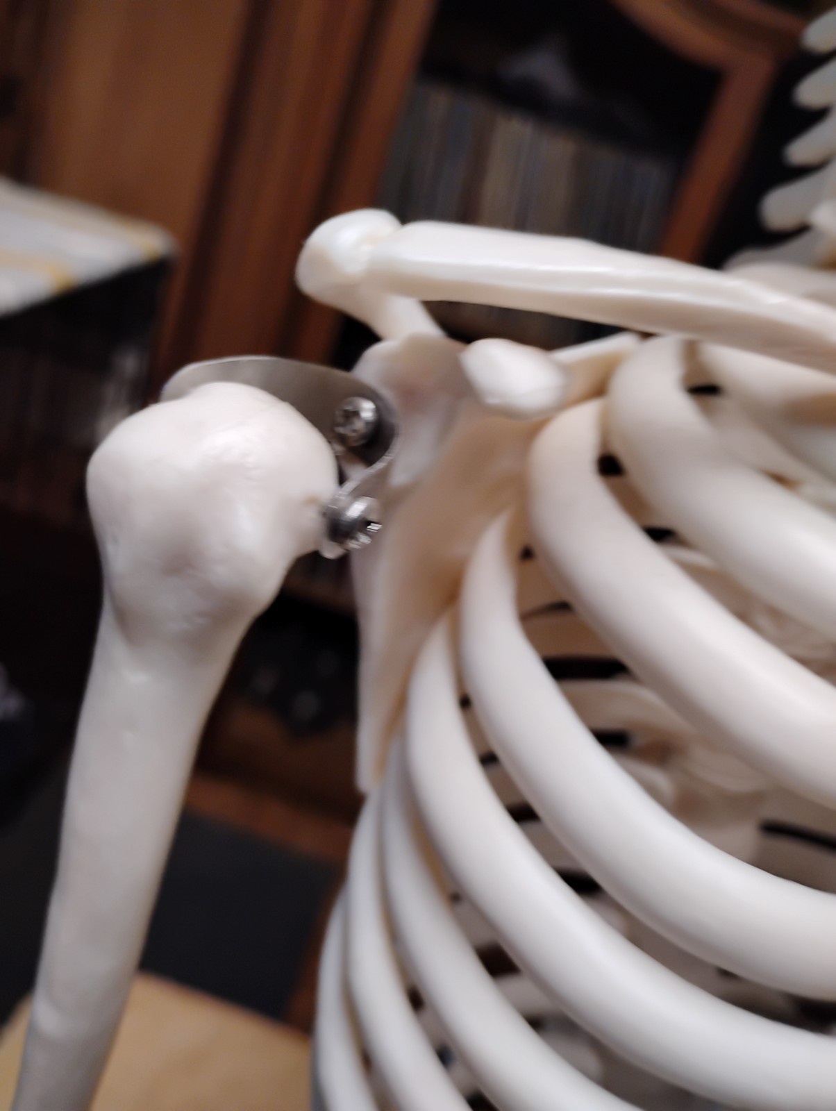 Medical Skeleton Model 33″ tall. Used in Good Condition.