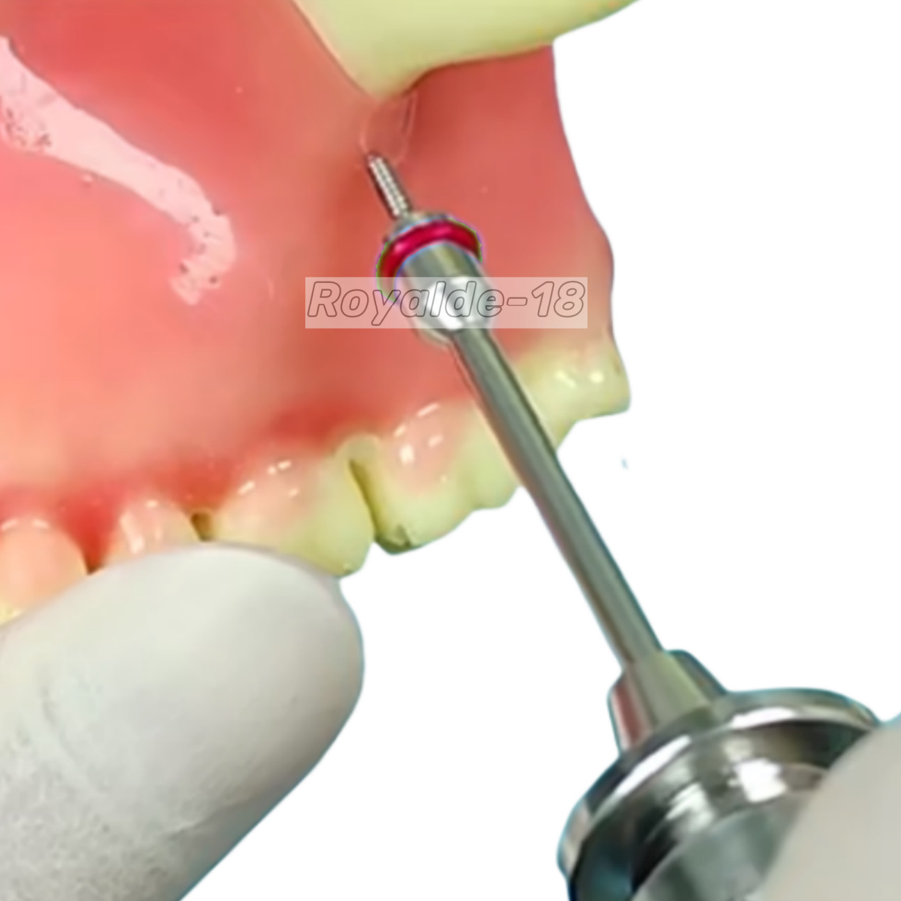 Dental TAS Mini Screw Anchorage Micro Screws Driver Orthodontic Vector Style