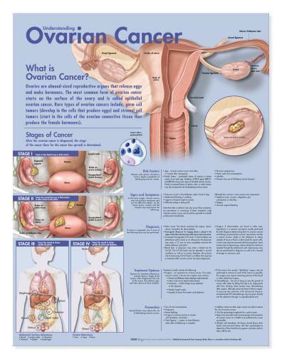 OVARIAN CANCER Laminated Wall Chart 20″ x 26″ Classroom/Professional LFA#92333