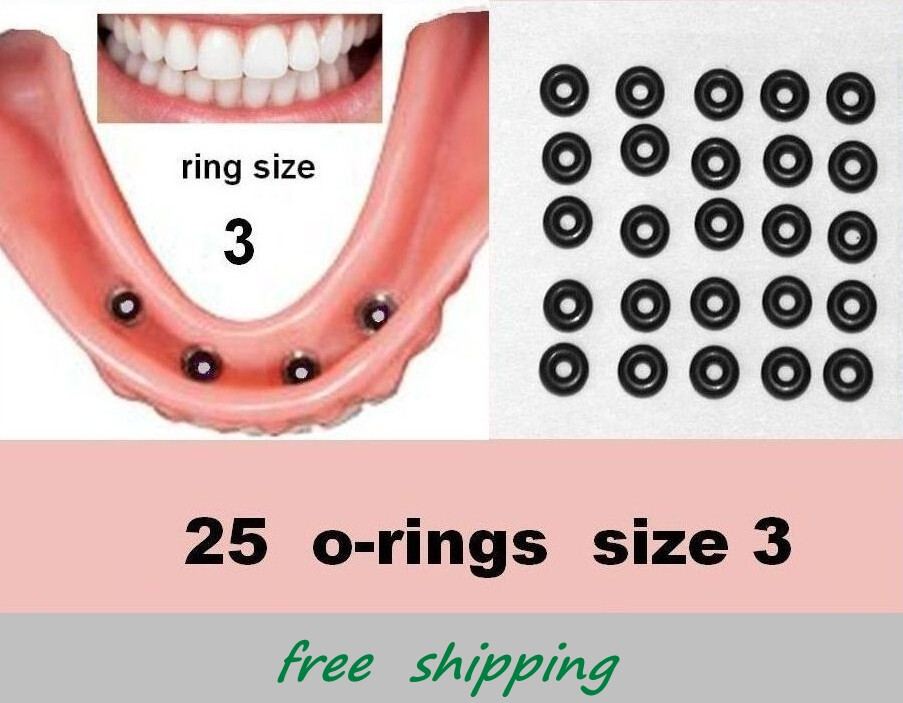 25 + 3 * rubber o-rings – my size 3 – for Mini Dental Implants 0351 a.o.