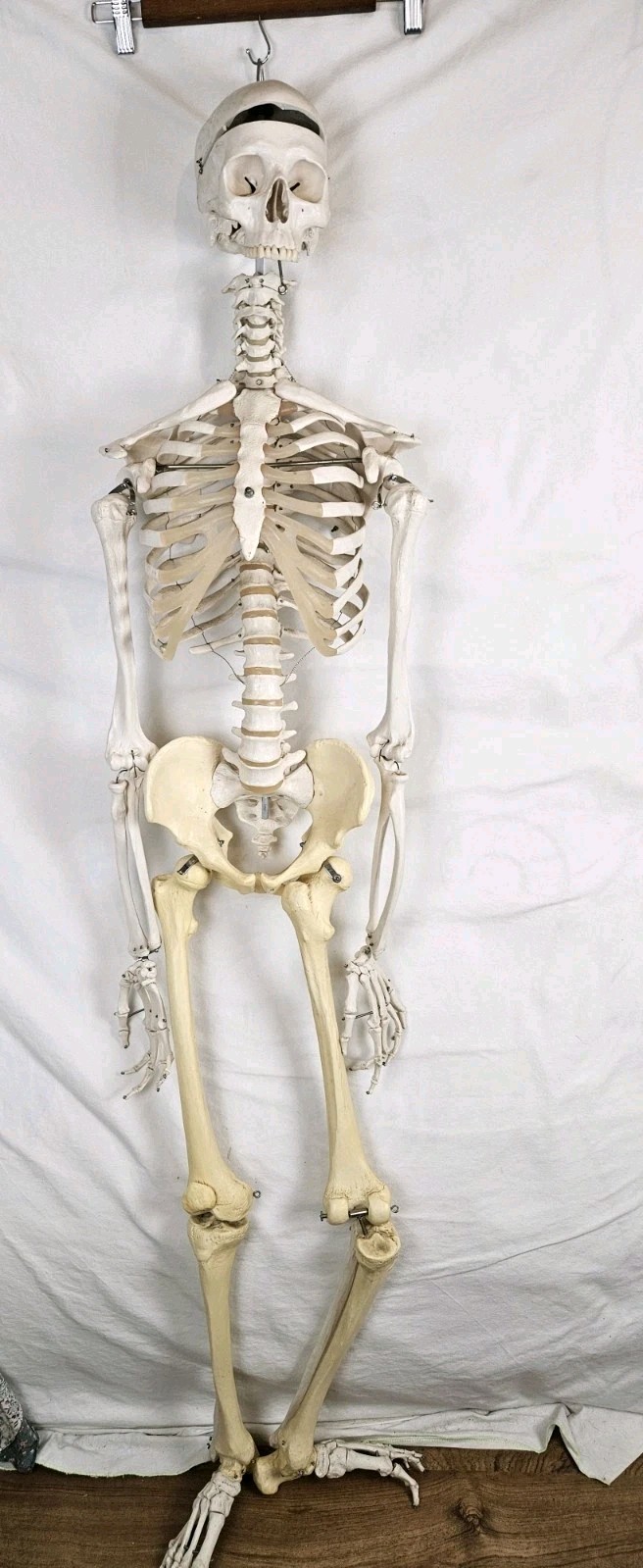 3B Scientific 5′ 6″ Human Skeleton Stan Hanging Model NO MANDIBLE