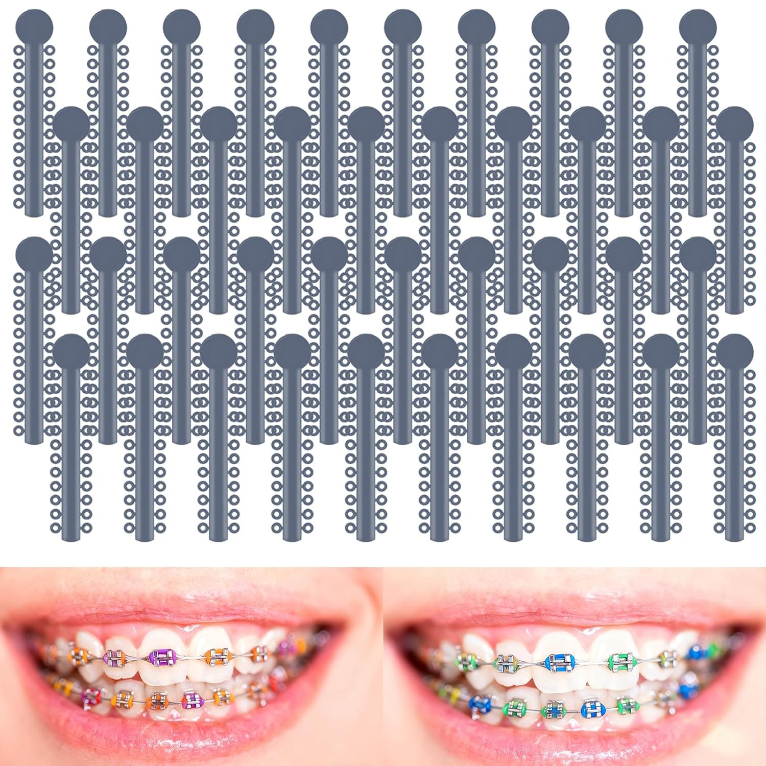 1040pcs Orthodontic Ligature Ties Dark Blue Elastomeric O-Rings Braces Bands