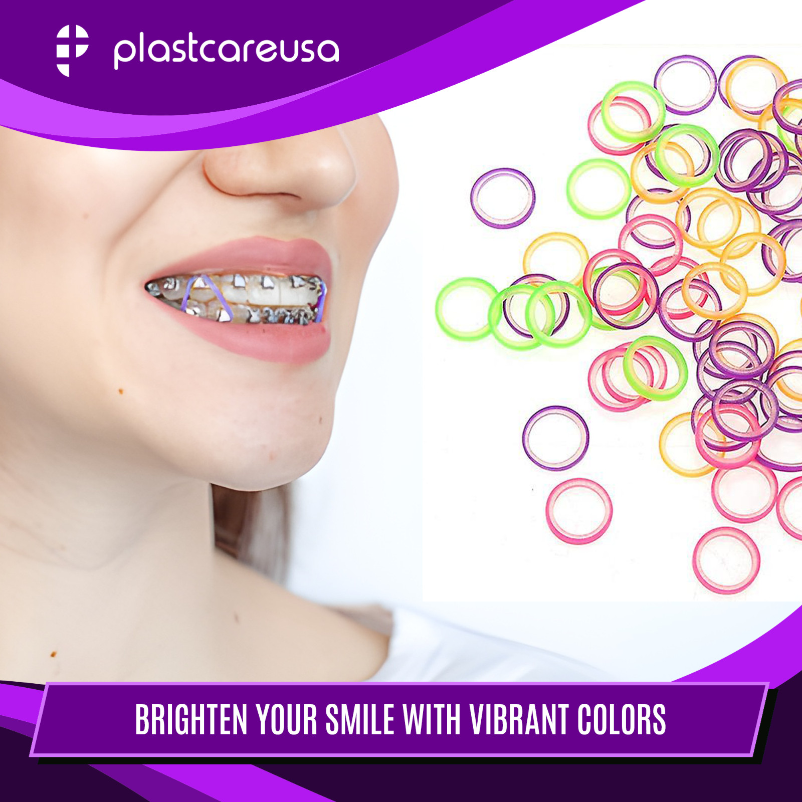 100 Assorted Color Light 3.5 Oz 5/16″ Penguin Latex Elastic Rubber Bands Braces