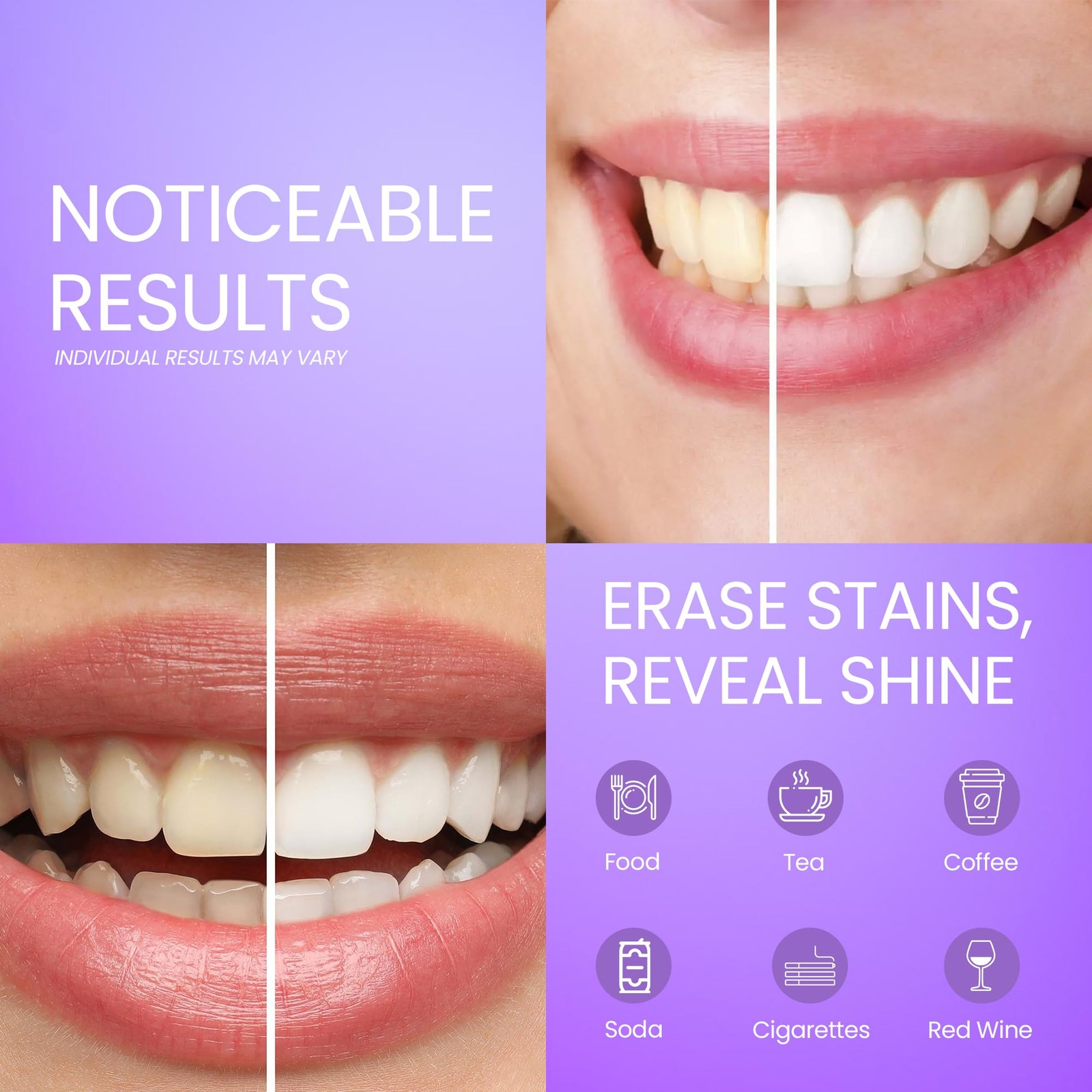 AFD Prime Purple Teeth Whitening Strips for 1 Count (Pack of 14),