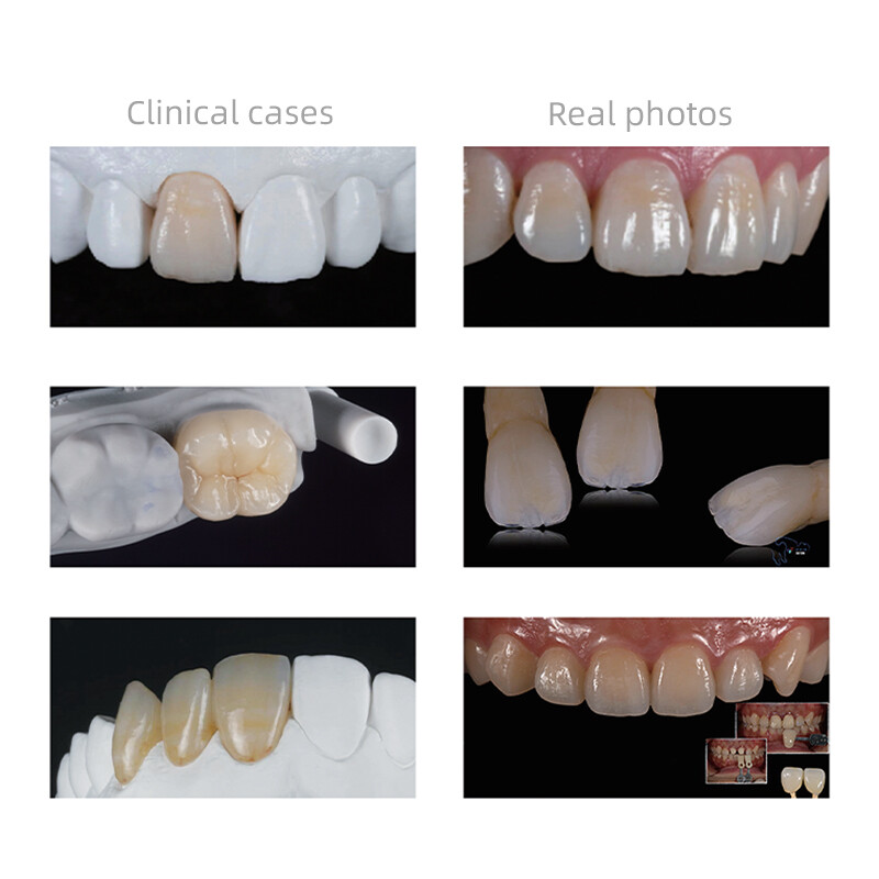 C14 Dental Lithium Disilicate Glass Ceramic Blocks CAD CAM for Planmeca 5pcs