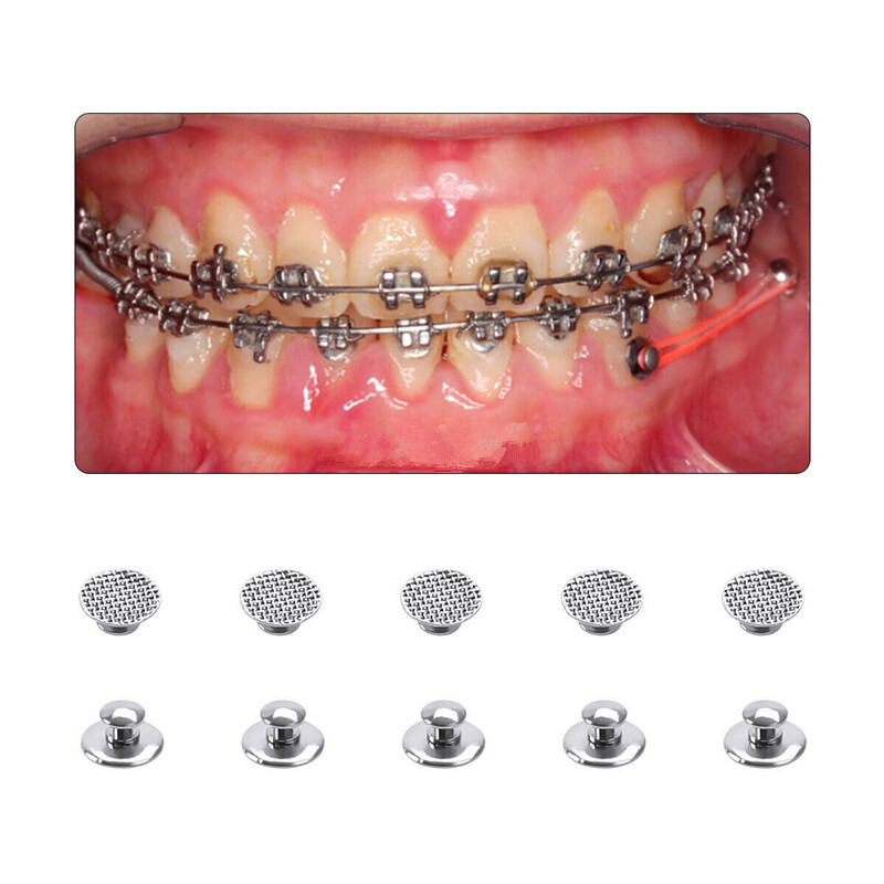 10 Pcs/Bag Dental Orthodontic Metal Round Mesh Base Lingual Button Bondable