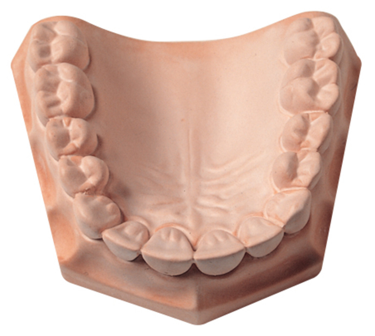 Whip-Mix 23690 Snap-Stone Dental Labstone Type IV Pink High Strength 11 Lb