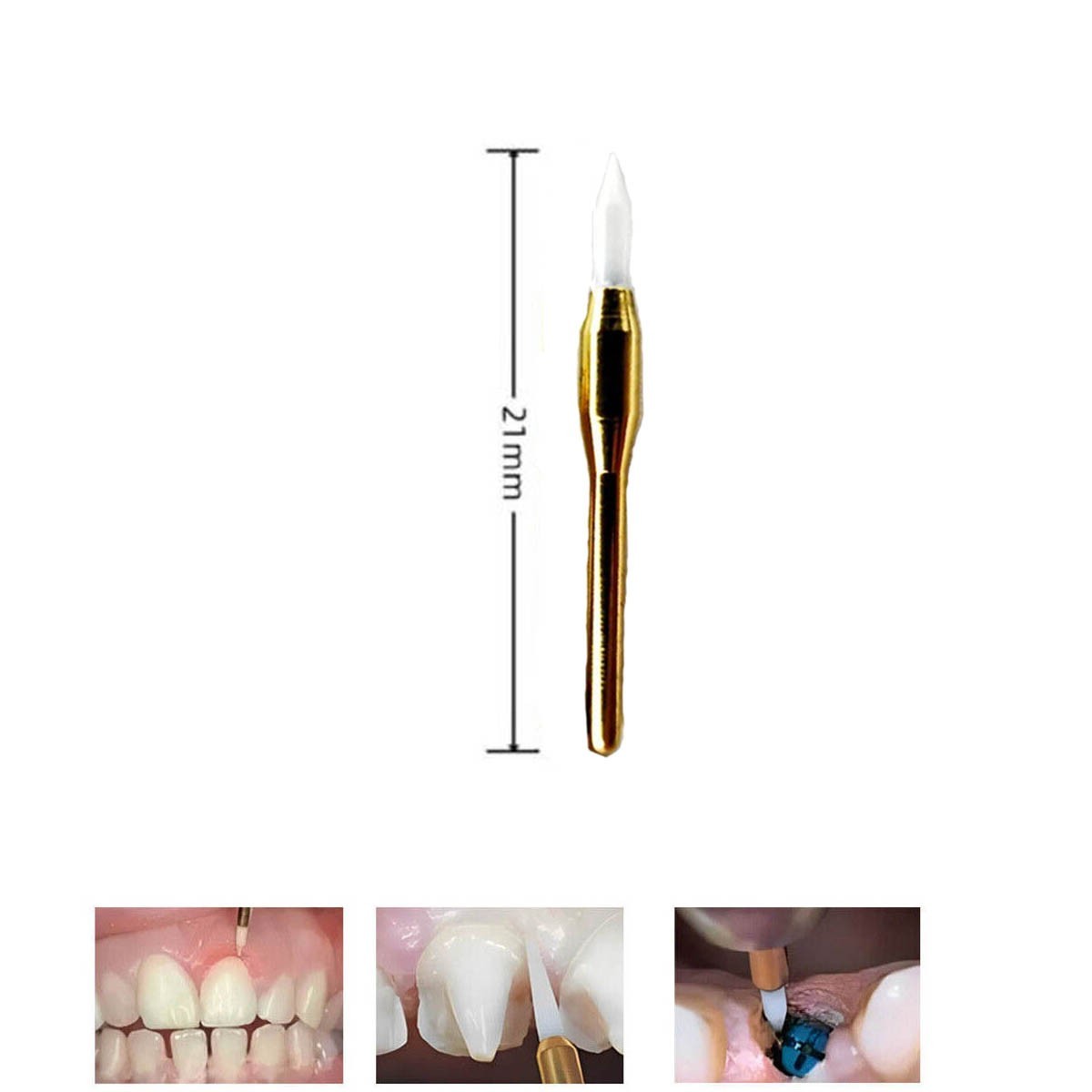 6PCS Soft Tissue Cutting Burs Friction Heating Achieves Rapid Hemostasis 21mm
