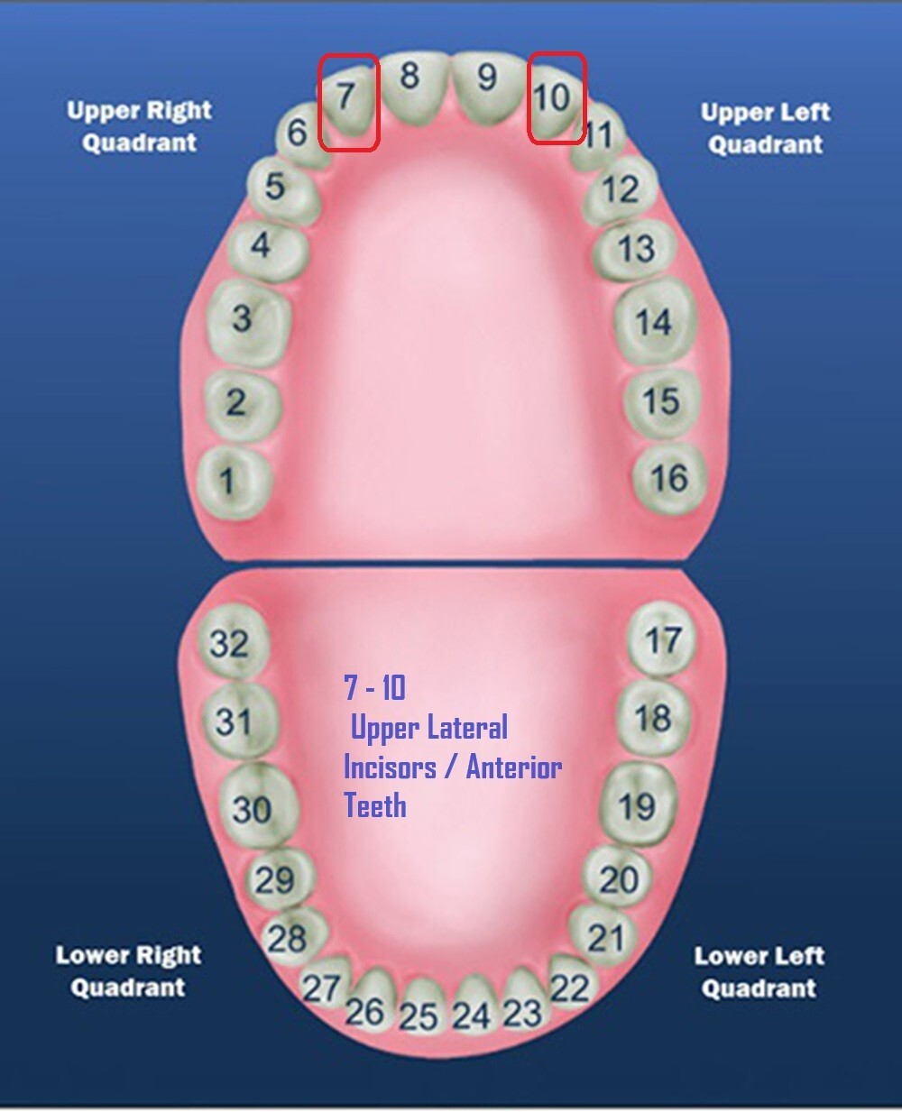 DENTAL POLYCARBONATE TEMPORARY CROWNS #23 (URL) UPPER RIGHT LATERAL 5/PACK