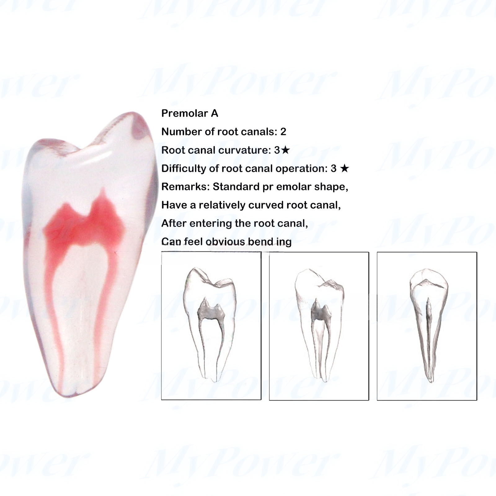 Dental Training 3D RCT Endo Tooth Model Practice Model Curved Root Resin Teeth