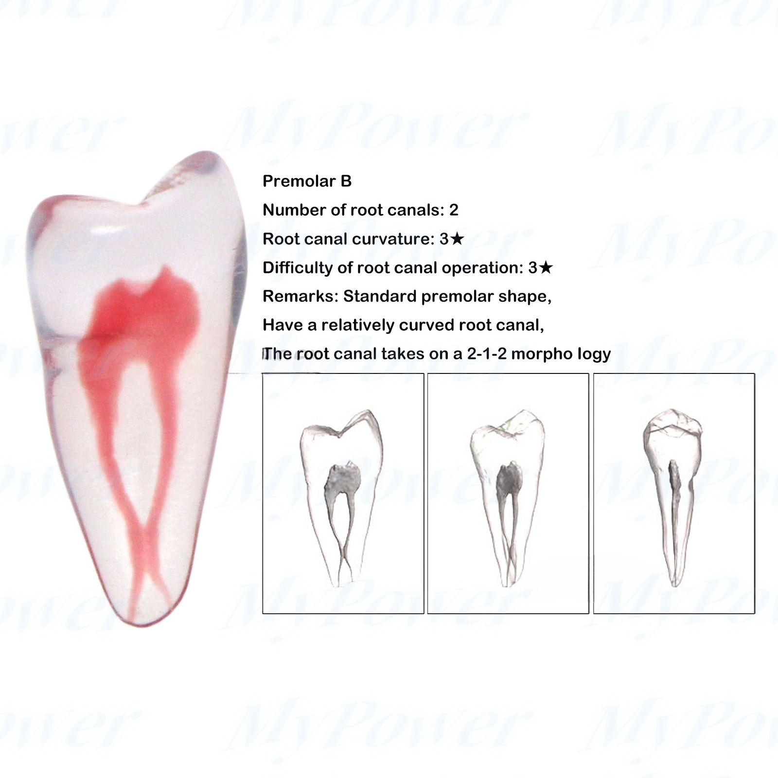 Dental Training 3D RCT Endo Tooth Model Practice Model Curved Root Resin Teeth