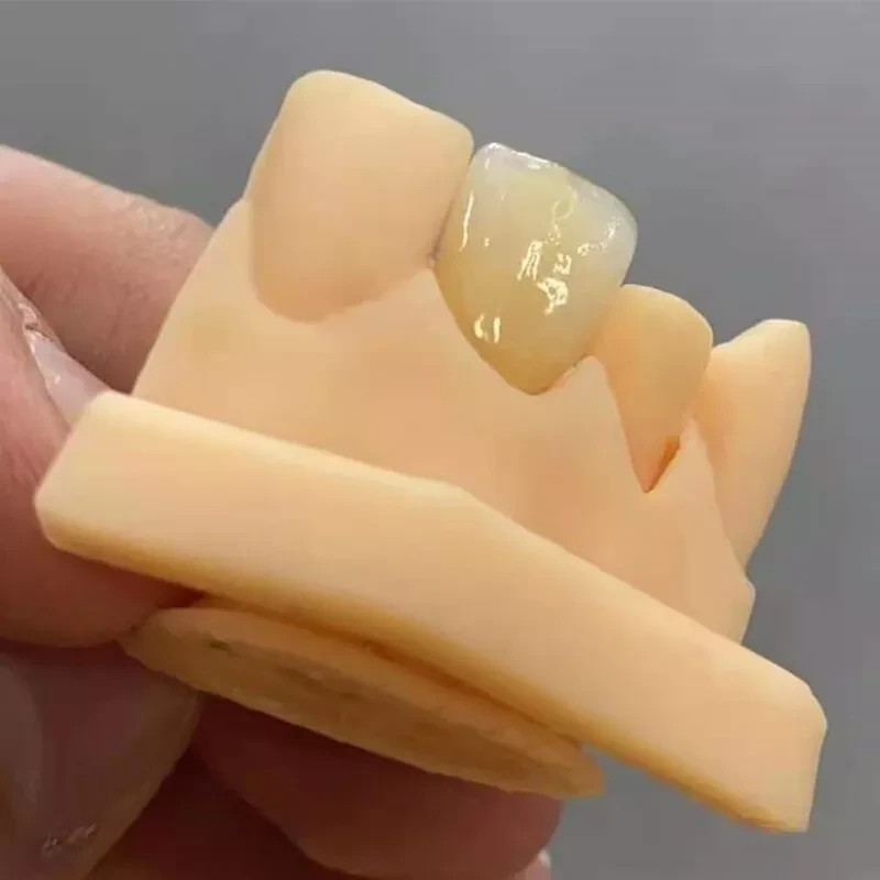 C14 Dental Emax Ceramic Blocks Lithium Disilicate CAD/CAM CEREC Block 5pcs A1 A3