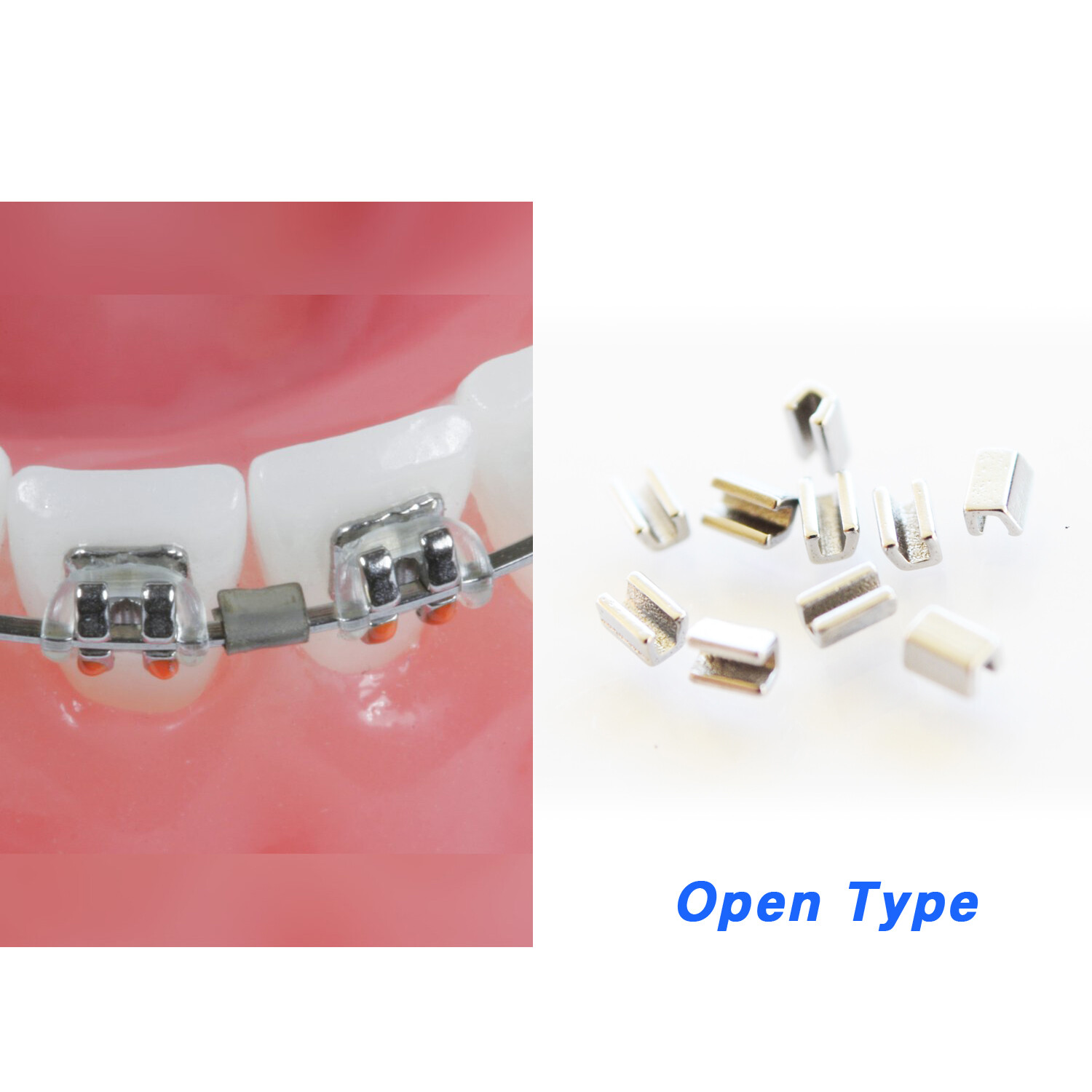 J&J Ortho™ Orthodontic Archwire Stop Open / Close Optional Size