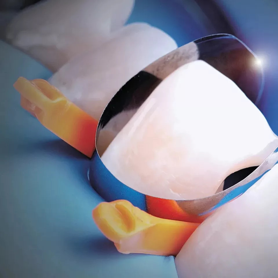Polydentia Unica Anterior Dental Matrix System Intro Kit II Free Ship