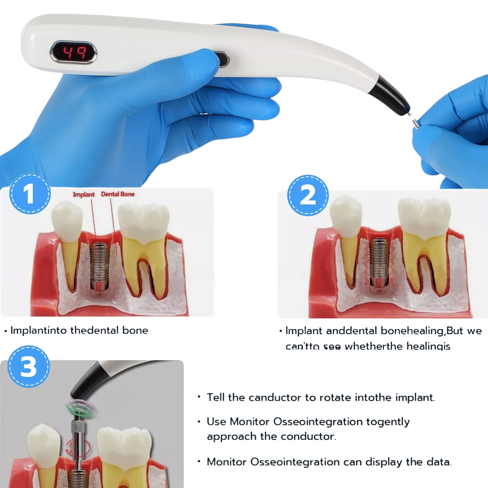 DENTAL NEW OSSTELL BEACON ISQ IMPLANT STABILITY METER