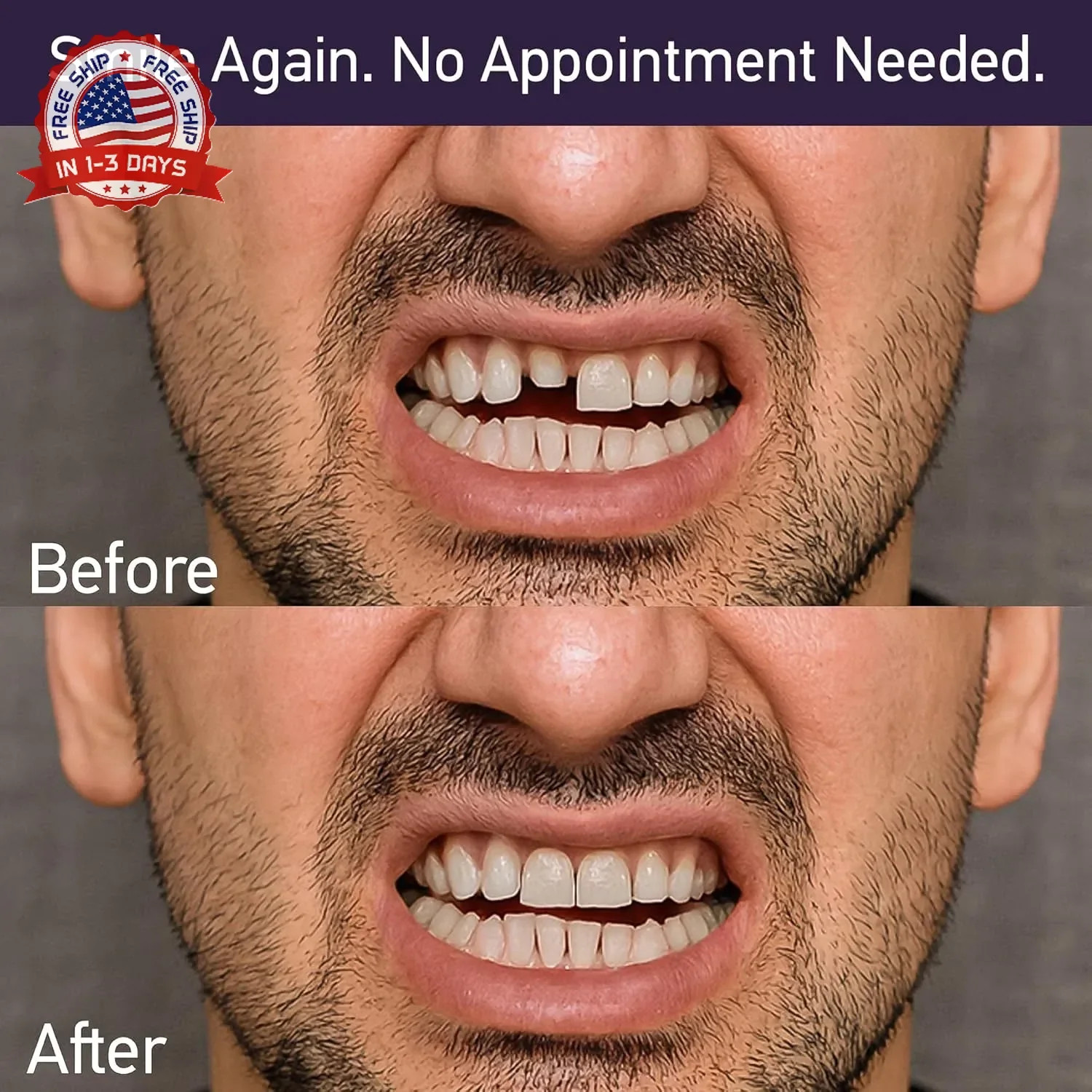 Dental Cement Kit – Zinc Oxide Eugenol Temporary Filling & Crown Repair | Tooth