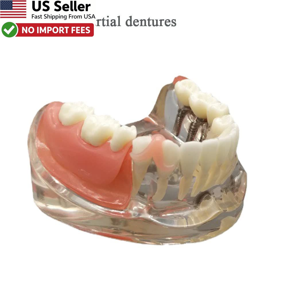 DIY Denture Gum Material Tooth Repair Kit Teeth Fitting Smile Improve FROM USA